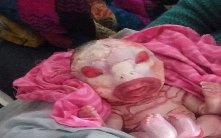 Alien Baby Born in Bihar